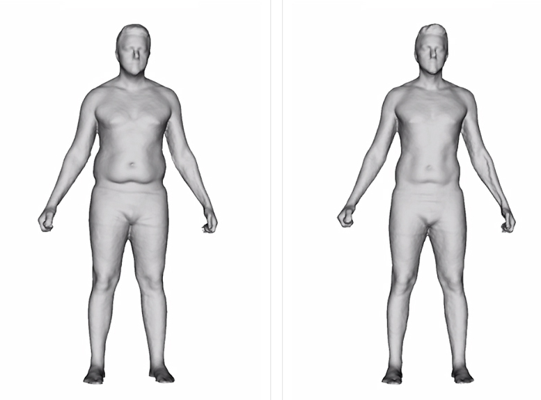 scanarea în greutate a corpului 3d