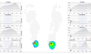 Baropodometrie și ortezare în București – evaluare completă la Centrul Superfit